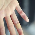 фото Белые тату от 19.02.2018 №019 - White Tattoo - tattoo-photo.ru