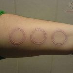 фото Белые тату от 19.02.2018 №041 - White Tattoo - tattoo-photo.ru