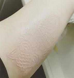 фото Белые тату от 19.02.2018 №075 - White Tattoo - tattoo-photo.ru