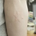 фото Белые тату от 19.02.2018 №093 - White Tattoo - tattoo-photo.ru