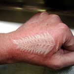фото Белые тату от 19.02.2018 №102 - White Tattoo - tattoo-photo.ru