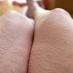 фото Белые тату от 19.02.2018 №161 - White Tattoo - tattoo-photo.ru
