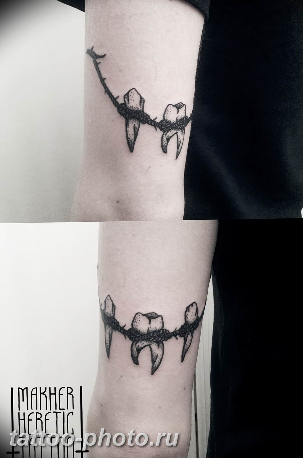 фото тату зуб 23.12.2018 №206 - photo tattoo tooth - tattoo-photo.ru -tattoo-photo.ru