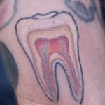 фото тату зуб 23.12.2018 №146 - photo tattoo tooth - tattoo-photo.ru