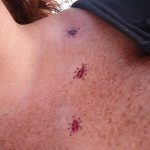 фото идея тату божья коровка 22.12.2018 №280 - photo ladybug tattool- tattoo-photo.ru