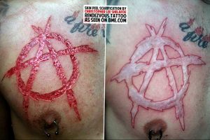Фото тату анархия на груди 24.03.2020 №002 -tattoo anarchy- tattoo-photo.ru